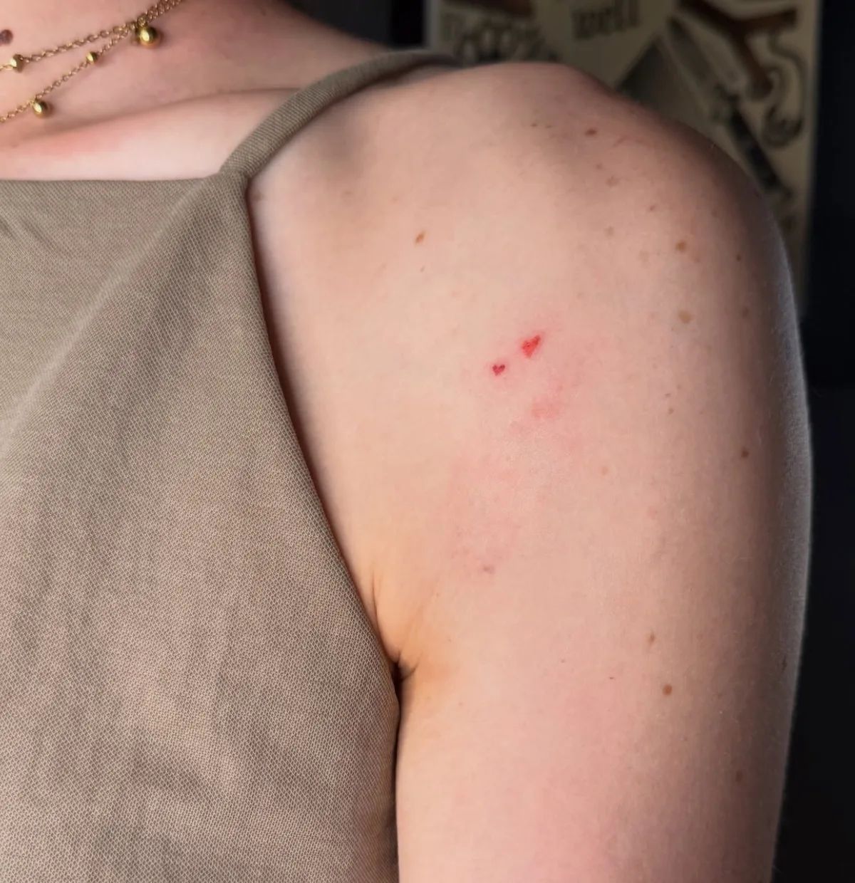 Two small red hearts tattoo on upper arm